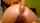 anal