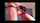 bondage teen