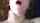 facial
