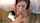 facial teen