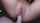 anal