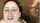 facial