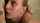 facial
