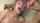 beauty facial teen