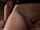 kink