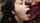facial