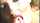 facial