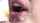 facial
