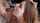 facial teen