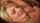 facial