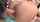 anal