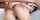 anal