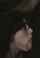 kink