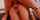 anal