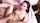 facial anal