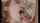facial