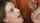 facial
