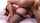 anal