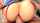 anal