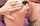 gape milk anal