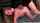 abuse anal ass