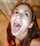 amateur tonsils braces