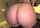 anal rough pain