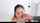 teen braces facial