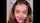 facial teen beauty