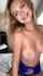 censored braces blonde