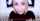 blonde braces eyes