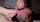 teen facial eyes