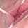 endoscope vaginal japanese