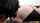 anal prolapse lesbian