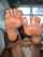 feet oil teen