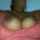 amateur anal asshole