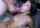 teen braces brunette