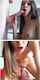 teen braces cam