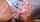 blonde hgf facial
