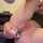 anal blonde prolapse