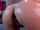 amateur anal prolapse