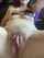 amateur labia birth marks