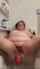 amateur bathtub prolapse