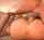 deep penetration vaginal deep vaginal