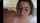 facial teen professional