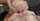 anal prolapse lesbian