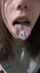 teen ahegao braces