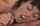 facial cim teen