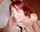 redhead facial pale white