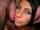 brunette lip fillers lip sore